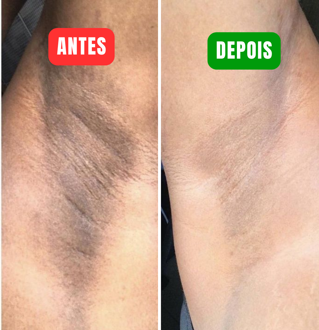 Vitamina C Cream - Veja sua pele mais clara em poucos minutos!