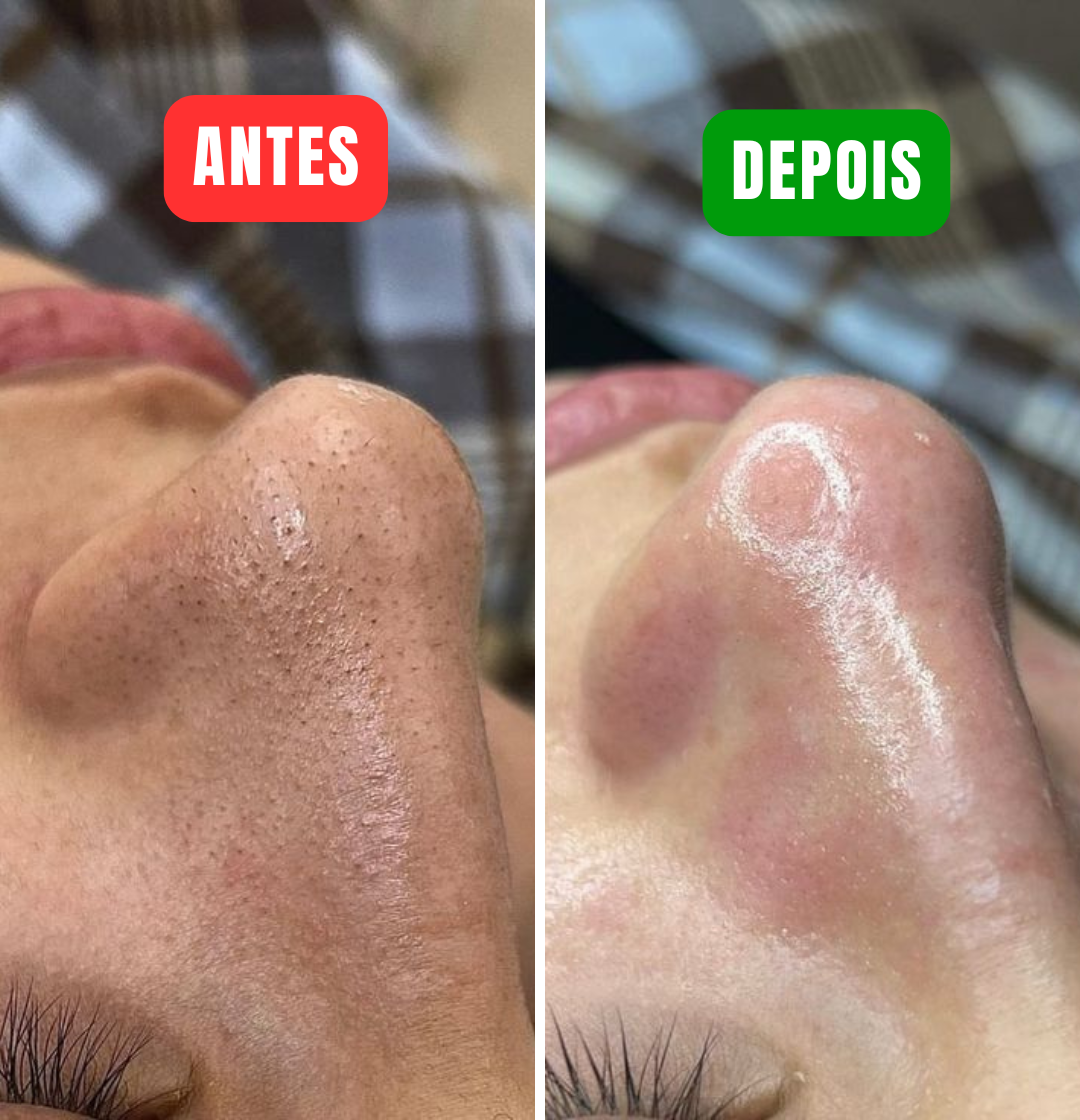 Máscara de Colágeno - Sua Pele Mais Jovem em Minutos! ( 1 Pincel de Brinde)