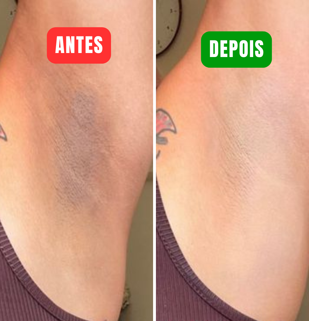 Vitamina C Cream - Veja sua pele mais clara em poucos minutos!